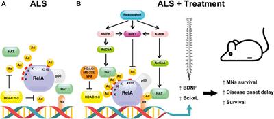 Synergistic association of resveratrol and histone deacetylase inhibitors as treatment in amyotrophic lateral sclerosis